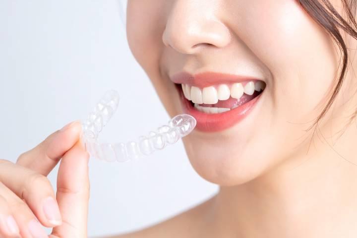 【歯科医が解説】インビザライン後のリテーナー、夜だけでいいって本当?
