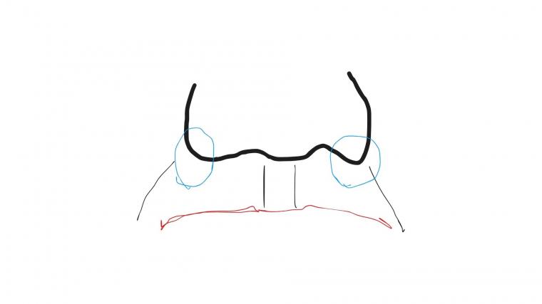 花粉症にはつらい季節