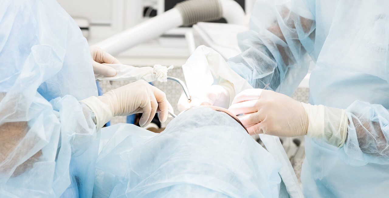 外科手術による重度な歯周病治療